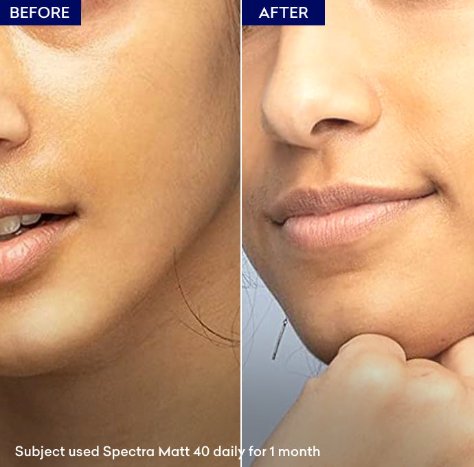 Spectra Matt SC SPF 40