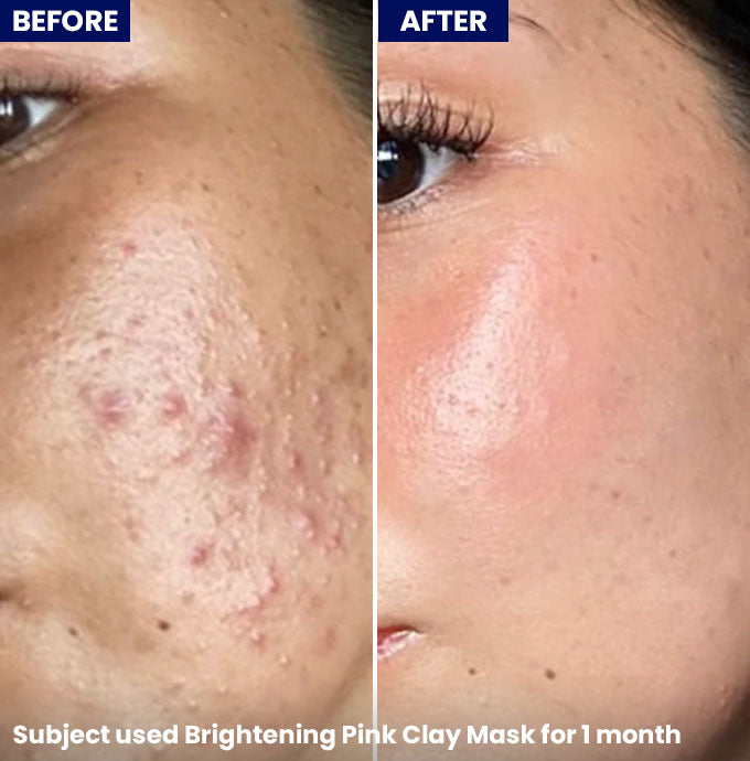 Brightening Pink Clay Mask