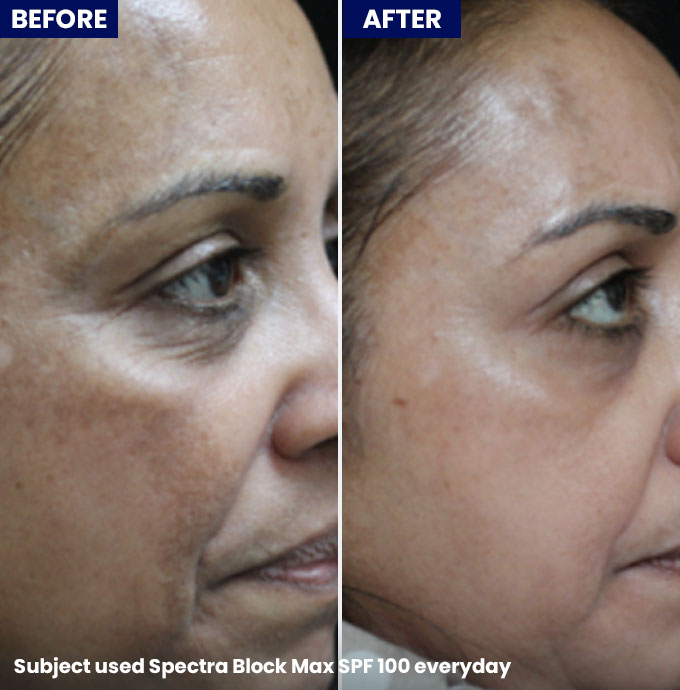 Spectra Block Max 100