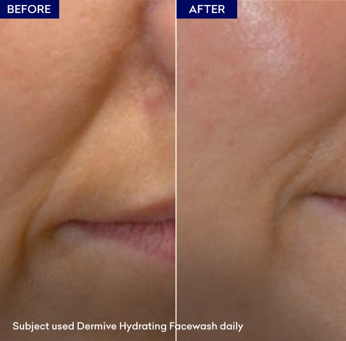 Dermive Moisturizing Wash