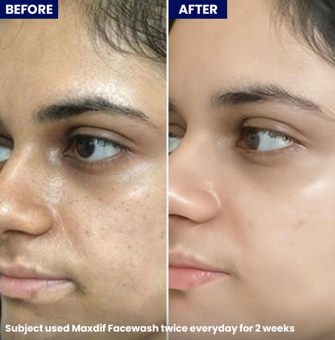 Maxdif Facewash
