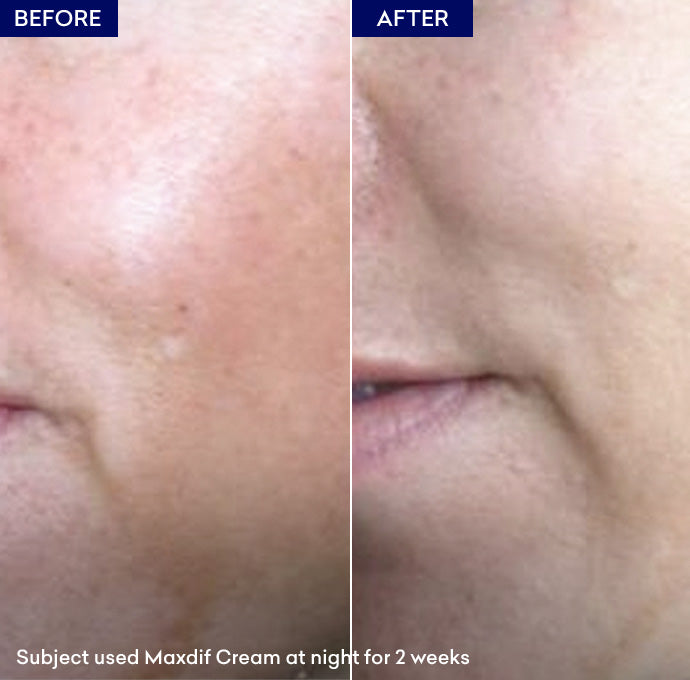 Maxdif Brightening Cream