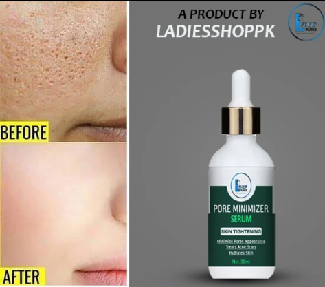 PORE MINIMIZER SERUM BY LADIES SHOP - 30ML
